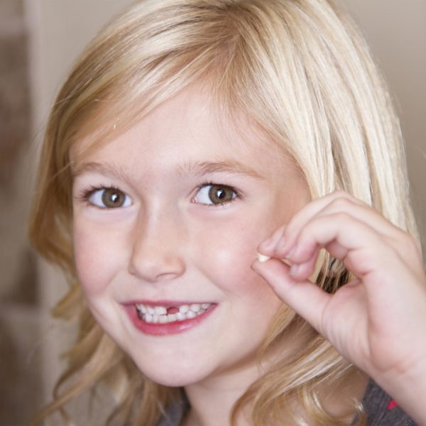 What You Should Know About Bite Problems with Children’s Teeth
